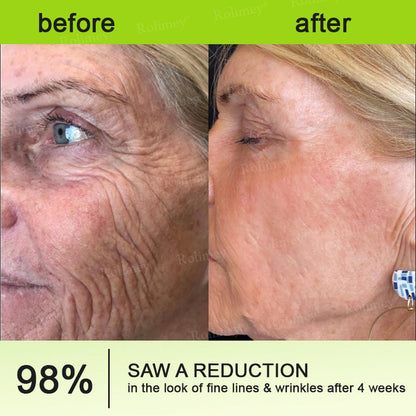 💫 Botox & Vita-A Retinol Shot Wrinkle-Lift Tightening cream - Last Day Promotion 70% OFF