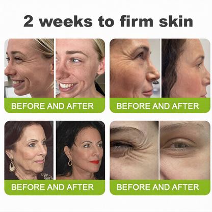 💫 Botox & Vita-A Retinol Shot Wrinkle-Lift Tightening cream - Last Day Promotion 70% OFF