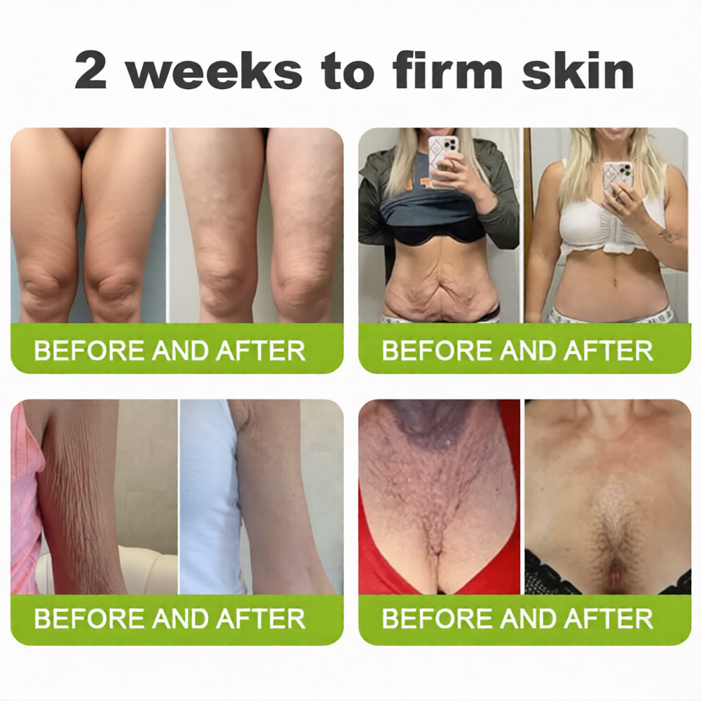 💫 Botox & Vita-A Retinol Shot Wrinkle-Lift Tightening cream - Last Day Promotion 70% OFF