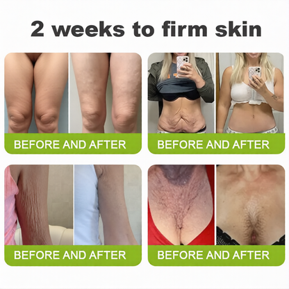 💫 Botox & Vita-A Retinol Shot Wrinkle-Lift Tightening cream - Last Day Promotion 70% OFF